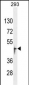 OR13J1 Antibody (C-term)